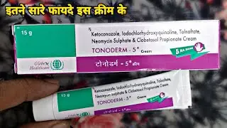 tonoderm 5 cream | सबसे best क्रीम |tonoderm 5 uses in hindi | Prince Azeemuddin | daad ki dawa