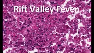 Rift Valley Fever