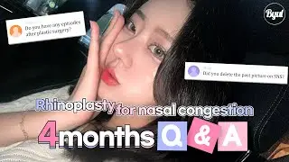 [Nose job VLOG] Functional rhinoplasty Q&A💗 | Rhinitis surgery congested nasal passages nosesurgery