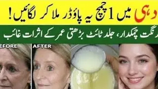 Best Face pack for glowing skin |Homemade Face Wash/potato & milk face pack For bright skin