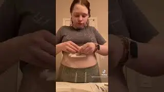 G-J FEEDING TUBE set up pt. 1 | how I access my J feeding tube with brand new tubing