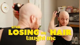 What I Learned From Losing My Hair