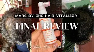 Mars By GHC 4 Months Final Review | Redensyl Hair Vitalizer | Redensyl Hair Before After Photos