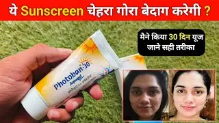 Photoban aquagel sunscreen | photoban aquagel sunscreen use kaise kare | photoban aquagel review 