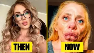 10 Celebrity Plastic Surgery Disasters &ndash; You&rsquo;d Never Recognize Them Today | Then and Now 2026