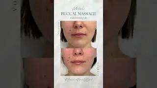 Buccal Massage Before and After 100% Verj&uuml;ngungseffekt PROFESSIONAL Falten gl&auml;tten und aufpolstern