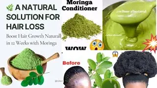#እንታይ ዘይ ገበረ  ጸጉርና እዚ ጎዲልዎ ኣብ ወርሒ ከምዚኣ  ማስክ የድልዮ ኣሎ ናይዚ ጥቅሚ ፍሉይ ዩ ሞሪንጋ አቲ ዝበለጸ  መድሃኒት 