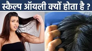 Oily Scalp क्यों होता है, ऑयली स्कैल्प होने का कारण, ऑयली स्कैल्प के उपाय |Boldsky*Health