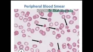 Hematology.... RBC's morphology 