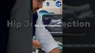 Welcome to my new series GUIDE THE NEEDLE! Part 1 Hip joint injection #mskus #ultrasound