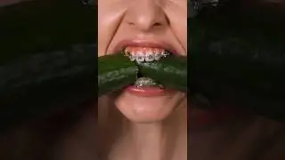 Брекеты с установкой и системой за 12.990r. Запись: Тел/Wa 8969 00040-40 Инстаграм yourclinic.ru