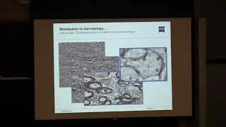 Introduction to Lattice SIM and Single Molecule Localization Microscopy