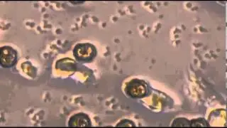 Single sphere phagocytosis with 11 micron spheres | Immunity Project