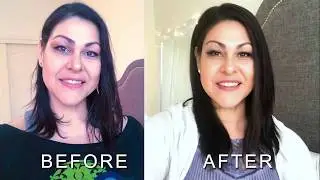 Hair Topper Review| Emily Human Hair Topper