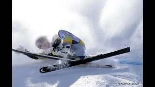 СЛОМАЛА НОГУ