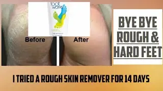 How I got rid of rough and hard feet/sole. This product made  the tough edges of my feet soft.🦶🙌