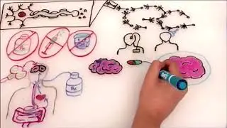 What are the benefits of non-invasive neurostimulation?