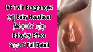 👉Twin Pregnancy in IVF: If One Baby&rsquo;s Heartbeat Stops, Will It Affect the Other Baby?Explanation