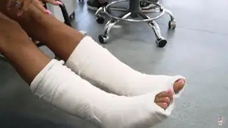 Katie Price explains how she broke both feet: &lsquo;It was a silly little accident&rsquo;  - Latest News