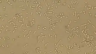 Yeast cells and short hyphae in wet mount of culture microscopy