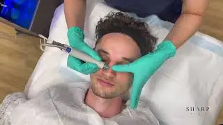 Hydrafacial For Male Skin Concerns