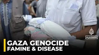 Famine in Gaza is not just food &mdash; it&rsquo;s water, disease, and despair: Physician from Gaza