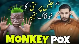 Monkey Pox is a global Threat | Monkey Pox Full Study analysis