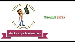 Question on Normal ECG Asked in NEET PG / DNB
