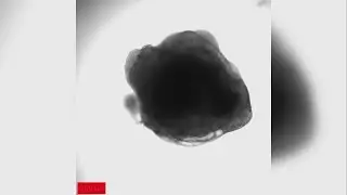 MSU researchers develop &lsquo;mini heart&rsquo; to advance atrial fibrillation treatment