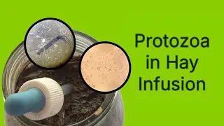 Protozoans Under the Scope (School Project Hay Infusion)