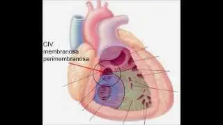1 Minuto de Imagem - CIV PERIMEMBRANOSA
