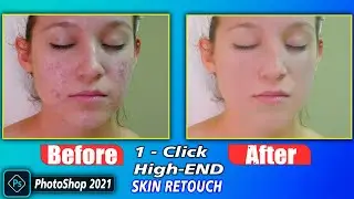 How to Remove Acne and Pimples in Photoshop in 2021 Photoshop Retouching Tutorial
