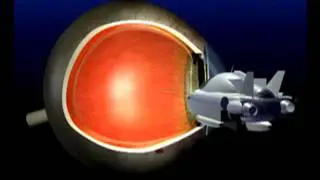 VitrectomyIndication-Introduction-1.flv
