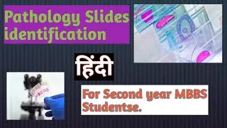 All pathology slides in one video for second year MBBS@pathologysimplified @drsparshguptapathology