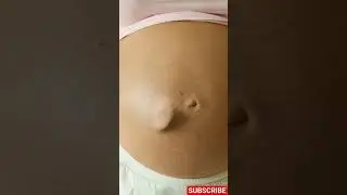 Why Do Babies Kick in the Womb?
