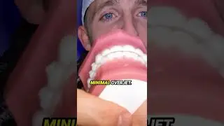 Как должен выглядеть ваш укус?