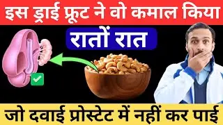 🤯 Say GoodBye To PROSTATE PROBLEMS Forever By Eating These POWERFUL Nuts Daily 