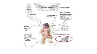 NICU equipment