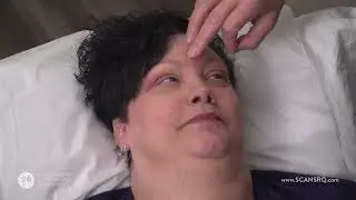 Unexpected Healing: My Journey Overcoming Dysphagia with Acupuncture | A Tale of Resilience