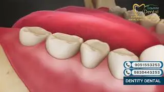 Teeth Explained: Types, Structure & Functions | Dentity Dental Guide for a Healthy Smile