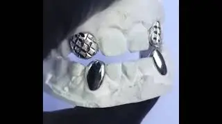 Diamond Dust Cut Top Incisors & Plain Bottom Canines. Metal: Silver