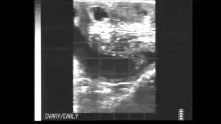 Bovine fetal age quiz final questions from BCF Technology HD