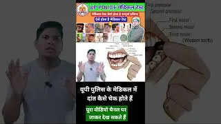 उत्तर प्रदेश पुलिस के मेडिकल टेस्ट में दांत कैसे चेक होते हैं, UP POLICE MADICAL TEATH TEST,