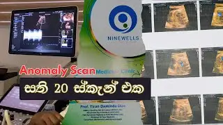 බබාගේ හැමදේම බලාගත්ත දවස | Full Anomaly Scan Video in Sri Lanka