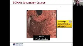 ANMS Virtual Symposia: Diagnostic and Therapeutic Approach to EGJ Outflow Obstruction