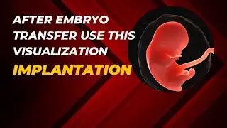 AFTER EMBRYO TRANSFER USE THIS VISUALIZATION TO HELP IMPLANTATION 
