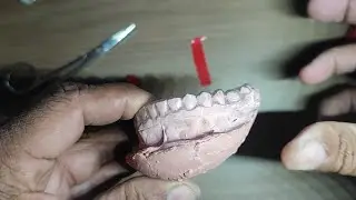 PLACA EM ACETATO - MACETE DE LABORATÓRIO - EM HD