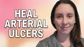 How to Treat Arterial Ulcers