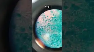 Microbacterium Tuberculosis Under Microscope 😲😲#microbiology #bacteria #shorts