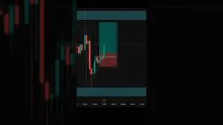 Live Gold Trading | Best Forex Scalping Strategy 2025 #shorts